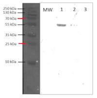 Cat2 | Catalase-2 in the group Antibodies for Plant/Algal  / Environmental Stress / Oxidative stress at Agrisera AB (Antibodies for research) (AS21 4531)